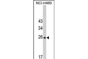 Western blot analysis of FKBP14 Antibody (N-term) (ABIN390491 and ABIN2840850) in NCI- cell line lysates (35 μg/lane). (FKBP14 antibody  (N-Term))
