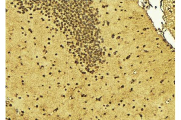 ZBTB40 antibody  (Internal Region)