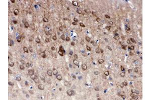 Anti- PGP9. (UCHL1 antibody  (C-Term))