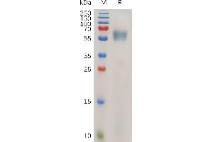 SDS-PAGE (SDS) image for Interleukin 1 Receptor Accessory Protein (IL1RAP) (AA 21-359) protein (His tag) (ABIN7490911)