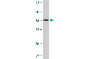 Western Blot detection against Immunogen (62. (PARVG antibody  (AA 1-331))