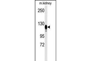 Western blot analysis of anti-EGFR Antibody  s in kidney heart tissue lysates (35 μg/lane). (EGFR antibody  (AA 1048-1077))