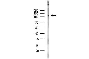 anti-LIM and Calponin Homology Domains 1 (LIMCH1) antibody
