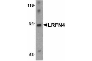 Image no. 1 for anti-Leucine Rich Repeat and Fibronectin Type III Domain Containing 4 (LRFN4) (C-Term) antibody (ABIN478053) (LRFN4 antibody  (C-Term))