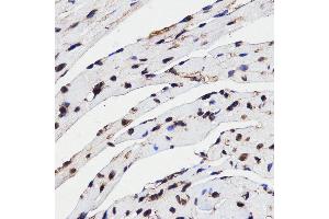 Immunohistochemistry (IHC) image for anti-High Mobility Group Box 1 (HMGB1) (AA 100-200) antibody (ABIN3023358) (HMGB1 antibody  (AA 100-200))