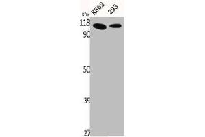Western Blot analysis of K562 293 cells using p115 Polyclonal Antibody (USO1 antibody  (C-Term))