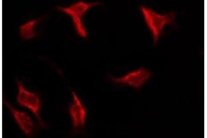 ABIN6275290 staining MCF7 by IF/ICC. (NCAM2 antibody  (Internal Region))