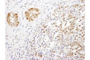 Immunohistochemistry (IHC) image for anti-Translin-Associated Factor X (TSNAX) (AA 240-290) antibody (ABIN7453532) (TSNAX antibody  (AA 240-290))