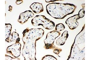 IHC-P: Nod1 antibody testing of human placenta tissue (NOD1 antibody  (AA 1-160))