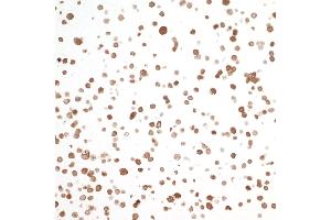 Immunocytochemistry (ICC) image for anti-Nicotinamide phosphoribosyltransferase (NAMPT) (AA 400-450) antibody (ABIN7454014) (Recombinant NAMPT antibody  (AA 400-450))