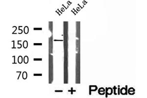 Western blot analysis of extracts of HeLa cells, using PTPN23 antibody.