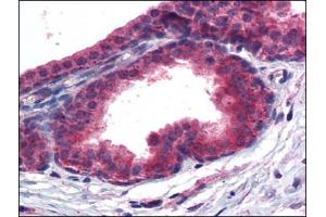 Immunohistochemistry Image: Human Prostate: Formalin-Fixed, Paraffin-Embedded (FFPE) (PPARD antibody  (C-Term))