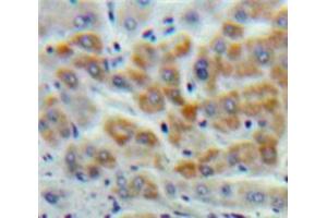 Used in DAB staining on fromalin fixed paraffin-embedded Liver tissue (Cystathionine (AA 14-224) antibody)