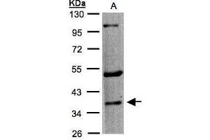 WB Image Sample(30 μg of whole cell lysate) A:A431, 10% SDS PAGE antibody diluted at 1:1000 (HTR1F antibody  (C-Term))
