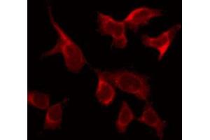 ABIN6269109 staining 293 by IF/ICC. (CSF1R antibody  (C-Term))