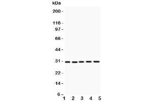 Western blot testing of CD82 antibody and Lane 1:  HL-60;  2: CEM;  3: HUT;  4: U937;  5: MCF-7