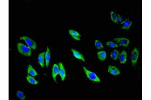 Immunofluorescent analysis of A549 cells using ABIN7174048 at dilution of 1:100 and Alexa Fluor 488-congugated AffiniPure Goat Anti-Rabbit IgG(H+L) (TIE1 antibody  (AA 217-328))