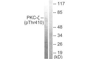 Western Blotting (WB) image for anti-Protein Kinase C, zeta (PRKCZ) (pThr410) antibody (ABIN5975889) (PKC zeta antibody  (pThr410))