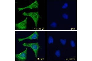 ABIN2613375-P1 Immunofluorescence analysis of paraformaldehyde fixed HeLa cells, permeabilized with 0.