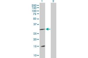 Western Blot analysis of DNAJC22 expression in transfected 293T cell line by DNAJC22 MaxPab polyclonal antibody. (DNAJC22 antibody  (AA 1-341))