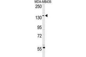 Western blot analysis in MDA-MB435 cell line lysates (35ug/lane) using CD227 / Mucin-1 / MUC1 Antibody . (MUC1 antibody  (AA 1209-1239))