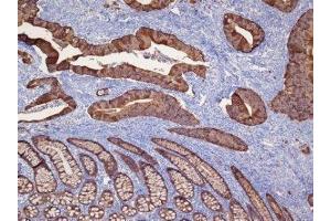 Immunohistochemistry (IHC) image for anti-Keratin 19 (KRT19) (C-Term) antibody (ABIN870576) (Cytokeratin 19 antibody  (C-Term))
