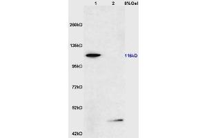 Lane 1: mouse testis lysates Lane 2: mouse pancreas lysates probed with Anti phospho-FAK(Ser722) Polyclonal Antibody, Unconjugated (ABIN711056) at 1:200 in 4 °C. (FAK antibody  (pSer722))