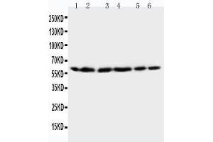 Anti-HSP60 antibody, Western blotting Lane 1: Rat Brain Tissue Lysate Lane 2: Rat Liver Tissue Lysate Lane 3: CEM Cell Lysate Lane 4: HELA Cell Lysate Lane 5: SMMC Cell Lysate Lane 6: COLO320 Cell Lysate