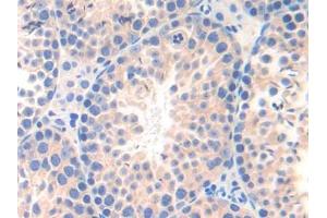 DAB staining on IHC-P; Samples: Mouse Testis Tissue (nectin-3 antibody  (AA 90-293))