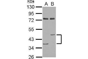 WB Image Sample (30 ug of whole cell lysate) A: A549 B: H1299 10% SDS PAGE antibody diluted at 1:1000 (Lipase A antibody  (Center))