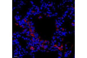 Immunofluorescence of paraffin embedded mouse lung using LRP (ABIN7074548) at dilution of 1: 250 (400x lens) (MVP antibody)