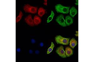 ABIN6258790 and ABIN6275947 staining Hela cells by IF/ICC.