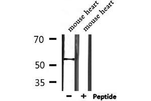 Western blot analysis of extracts from mouse heart, using TRMT11 Antibody.