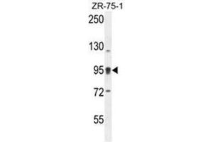 ACAP1 Antibody (N-term) western blot analysis in ZR-75-1 cell line lysates (35ug/lane). (ACAP1 antibody  (N-Term))