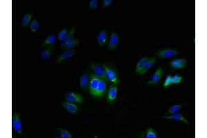 Immunofluorescent analysis of HepG2 cells using ABIN7173175 at dilution of 1:100 and Alexa Fluor 488-congugated AffiniPure Goat Anti-Rabbit IgG(H+L) (FAM70A antibody  (AA 110-225))
