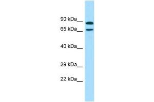 WB Suggested Anti-POF1B Antibody Titration: 1. (POF1B antibody  (C-Term))