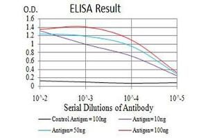 Black line: Control Antigen (100 ng),Purple line: Antigen (10 ng), Blue line: Antigen (50 ng), Red line:Antigen (100 ng) (IGHM antibody  (AA 310-452))