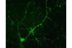Immunostaining of cultured mouse caudate neurons showing synapsin I when phosphorylated at Ser549. (SYN1 antibody  (pSer549))