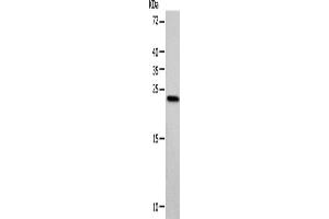 Western blot analysis of Hela cells using VSNL1 Polyclonal Antibody at dilution of 1:900 (VSNL1 antibody)