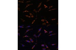 Immunofluorescence analysis of L929 cells using RPL28 antibody (ABIN7270001) at dilution of 1:100. (RPL28 antibody  (AA 1-100))