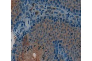Used in DAB staining on fromalin fixed paraffin- embedded Kidney tissue (CGB antibody  (AA 55-153))