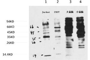 Western blot analysis of 1) Jurkat, 2) 293T, 3) Rat Brain Tissue, 4) Mouse Brain Tissue with Phosphotyrosine Mouse mAb diluted at 1:2000. (Phosphotyrosine antibody)