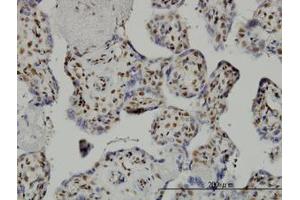 Image no. 2 for anti-TAF7 RNA Polymerase II, TATA Box Binding Protein (TBP)-Associated Factor, 55kDa (TAF7) (AA 130-224) antibody (ABIN598954) (TAF7 antibody  (AA 130-224))