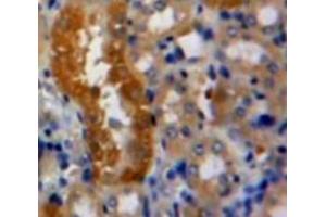 Used in DAB staining on fromalin fixed paraffin-embedded Kidney tissue (RNH1 antibody  (AA 76-333))
