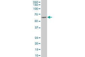 RPN2 polyclonal antibody (A01), Lot # 051220JC01 Western Blot analysis of RPN2 expression in A-431 . (Ribophorin II antibody  (AA 141-239))