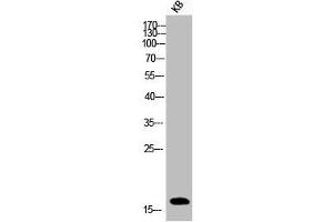 Western Blot analysis of KB cells using Phospho-Histone H3 (S10) Polyclonal Antibody (HIST1H3A/HIST2H3A/H3F3A (pSer10) antibody)