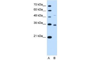 SLC38A3 antibody used at 1 ug/ml to detect target protein. (SLC38A3 antibody  (N-Term))