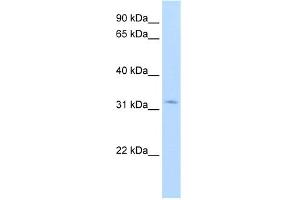 WB Suggested Anti-HSD17B6 Antibody Titration:  1. (HSD17B6 antibody  (N-Term))