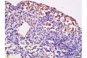 Formalin-fixed and paraffin embedded rat lung labeled with Anti-CD86/B7-2 Polyclonal Antibody, Unconjugated (ABIN736701) at 1:200 followed by conjugation to the secondary antibody and DAB staining. (CD86 antibody  (AA 140-175))
