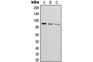 Western blot analysis of CD54 (pY512) expression in Saos2 (A), HepG2 TNFa-treated (B), Raji (C) whole cell lysates. (ICAM1 antibody  (C-Term, pTyr512))